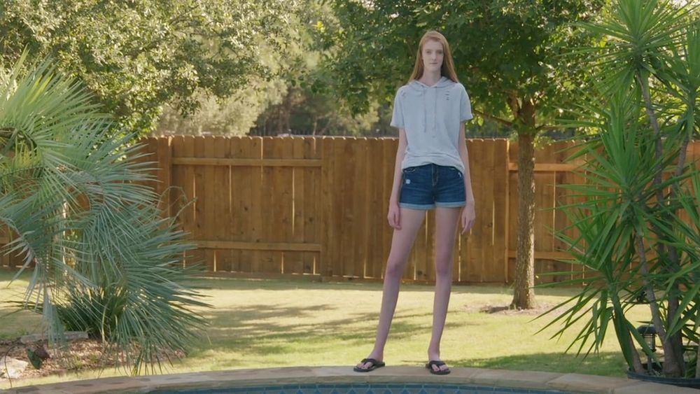 The Teen Who Has the Worlds’ Longest Legs According to Guinness